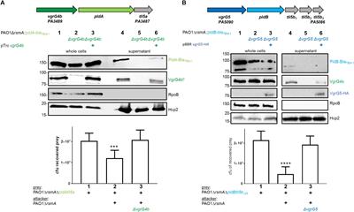 Delivery of the Pseudomonas aeruginosa Phospholipase Effectors PldA and PldB in a VgrG- and H2-T6SS-Dependent Manner